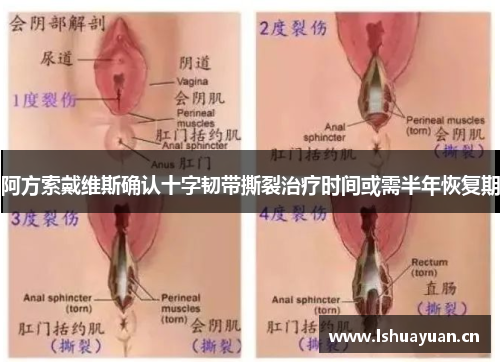 阿方索戴维斯确认十字韧带撕裂治疗时间或需半年恢复期